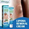 Lopoma Removal Cream ( 2pc )
