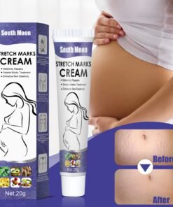 South Moon Stretch Marks Cream( 1pc )